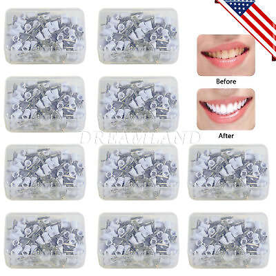 #ad 100 1000x Dental Rubber Prophy Tooth Teeth Polish Polishing Cups Latch Type $15.18