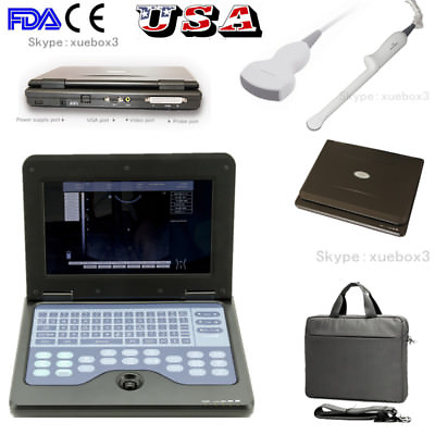 #ad CONTEC CMS600P2 Laptop Ultrasound Scanner Portable Machine2 Probes USA FEDEX $1649.00
