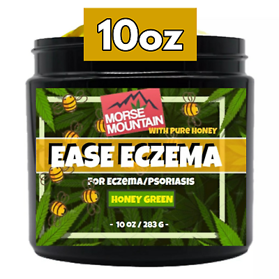 #ad Eczema Psoriasis Honey Cream Natural Ointment Dermatitis Treatment $29.87